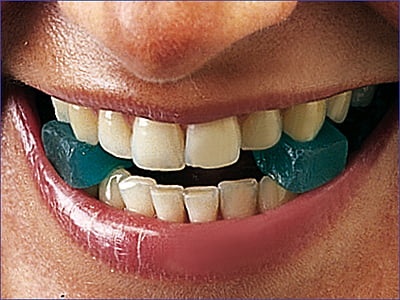 Gripit Arranca coronas adhesivo Gripit Arranca coronas adhesivo