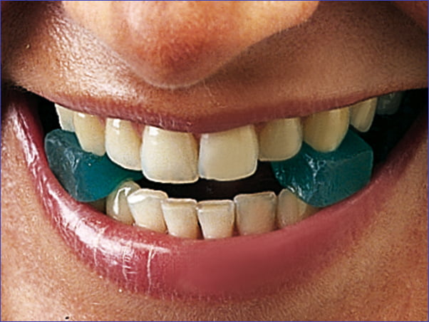 Gripit Arranca coronas adhesivo Gripit Arranca coronas adhesivo