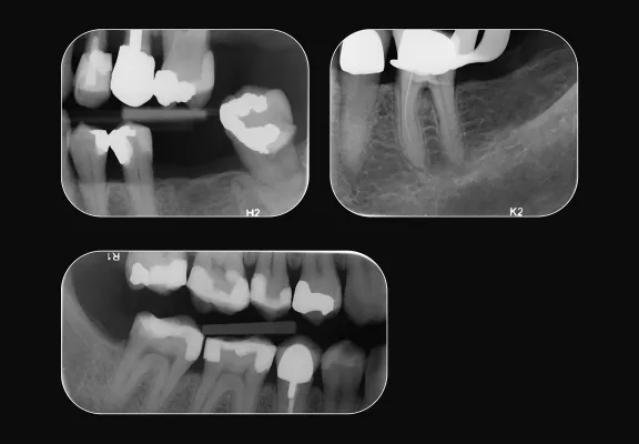Scanner per lastre ai fosfori SCAN EXAM DEXIS Scanner per lastre ai fosfori SCAN EXAM DEXIS