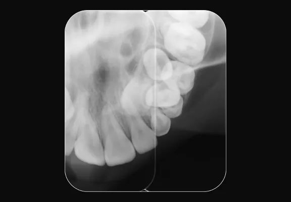 Scanner per lastre ai fosfori SCAN EXAM DEXIS Scanner per lastre ai fosfori SCAN EXAM DEXIS