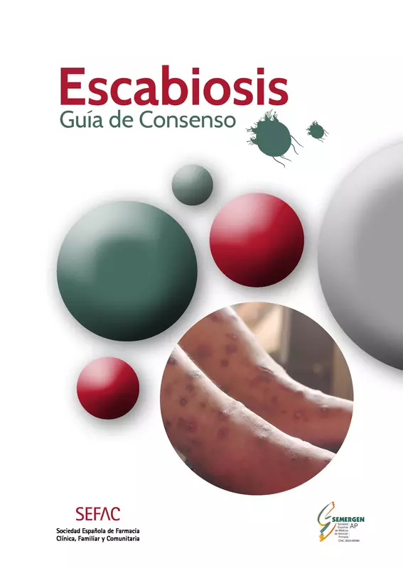 ESCABIOSIS. GUÍA DE CONSENSO.