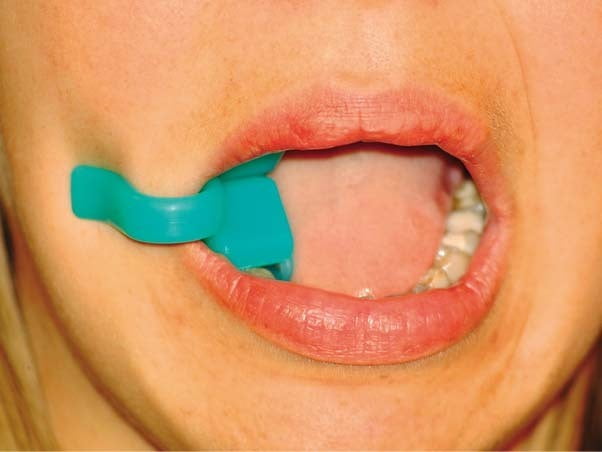 Abrebocas Mirahold Block Abrebocas Mirahold Block